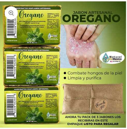 Savon pou lotà,gratèl,eczema  | JouxSkincareBoutique